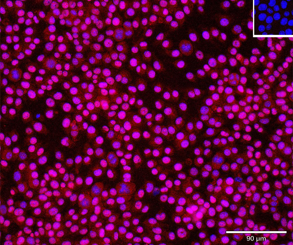 Ankyron VTNC_MOUSE Clone DJ41073