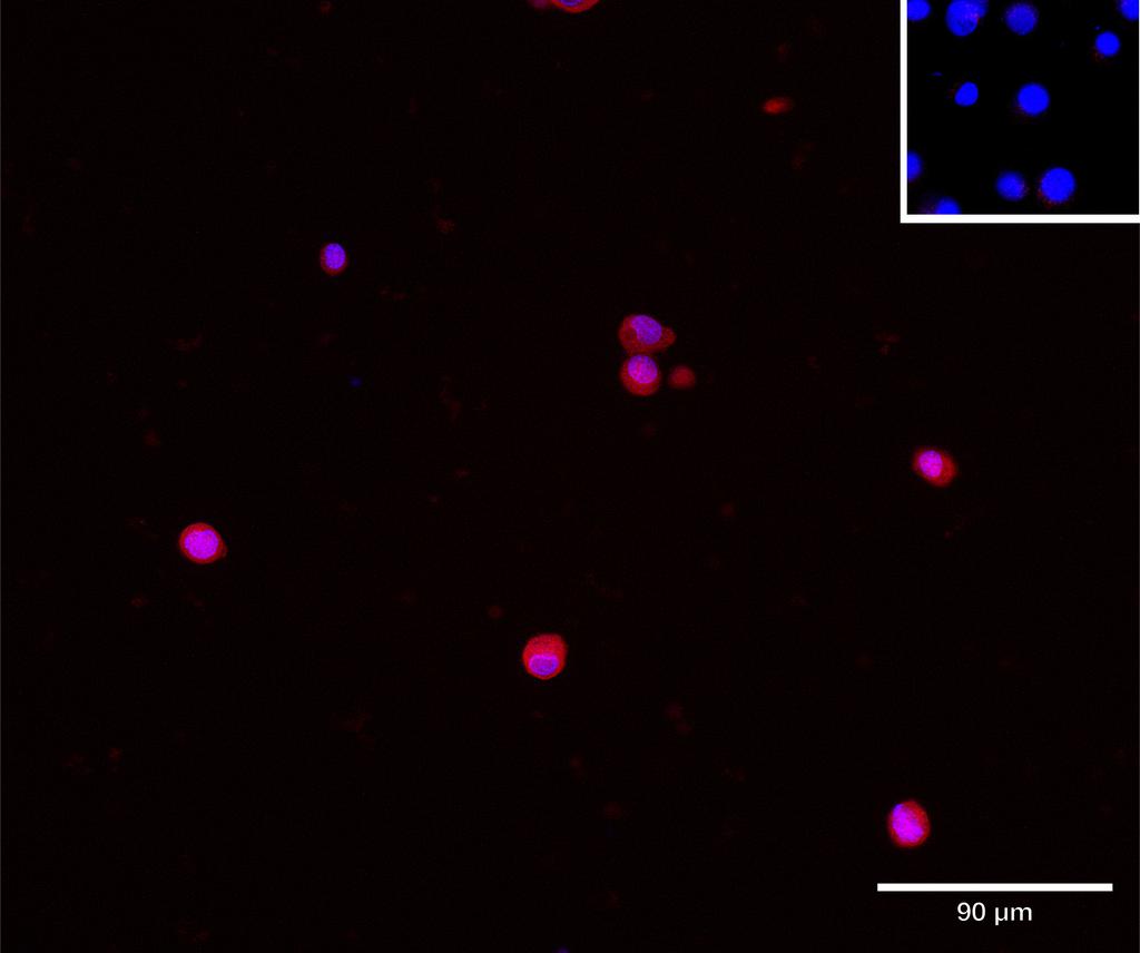 Ankyron WFKN2_HUMAN Clone AN40172