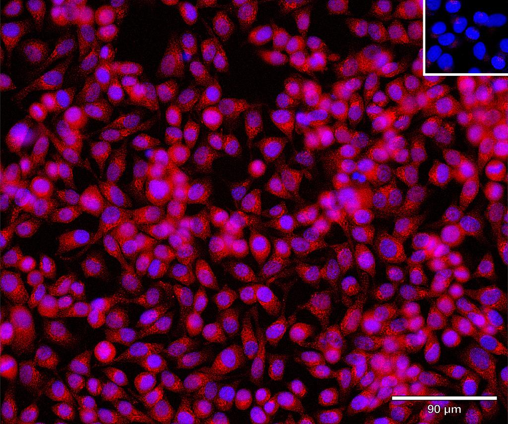 Ankyron WNT5A_HUMAN Clone CF30216