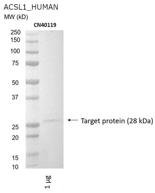 Ankyron ACSL1_HUMAN Clone CN40119