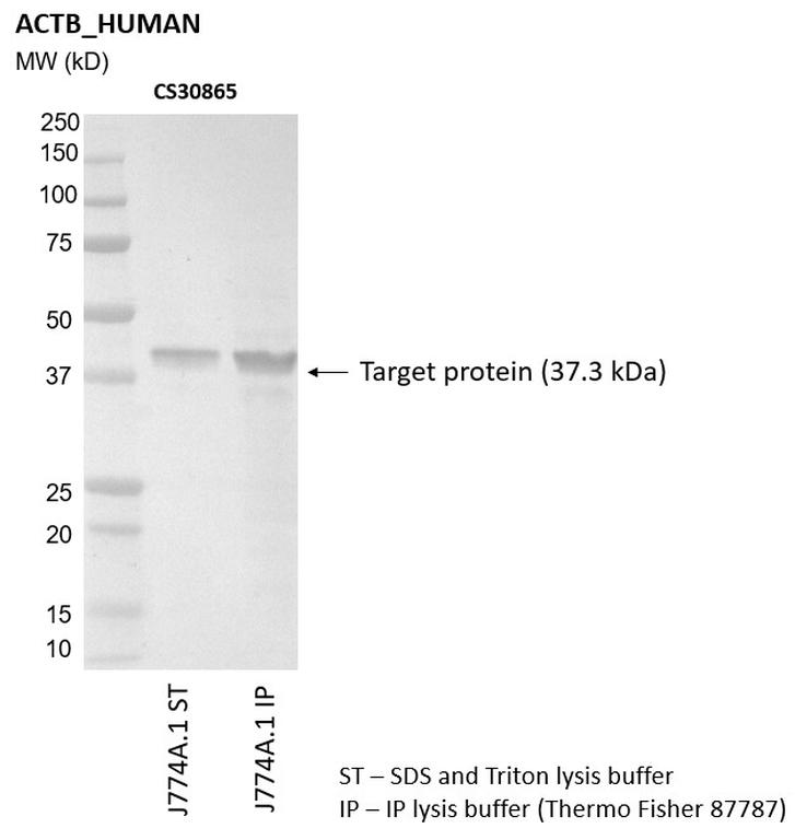 Ankyron ACTB_HUMAN Clone CS30865