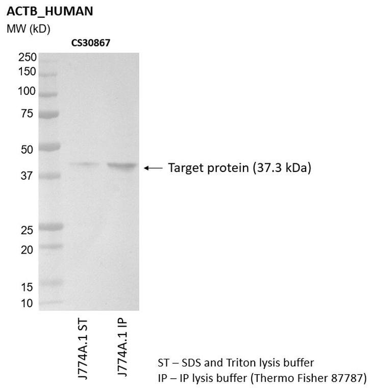 Ankyron ACTB_HUMAN Clone CS30867