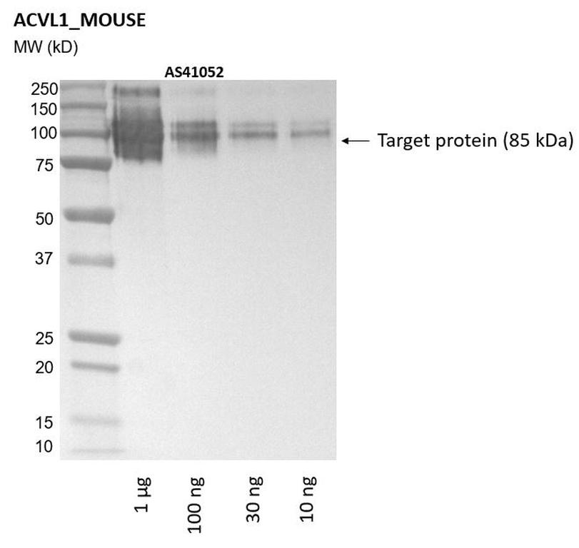 Ankyron ACVL1_MOUSE Clone AS41052