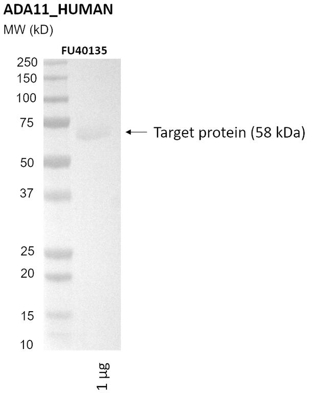 Ankyron ADA11_HUMAN Clone FU40135