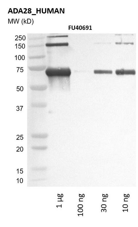 Ankyron ADA28_HUMAN Clone FU40691