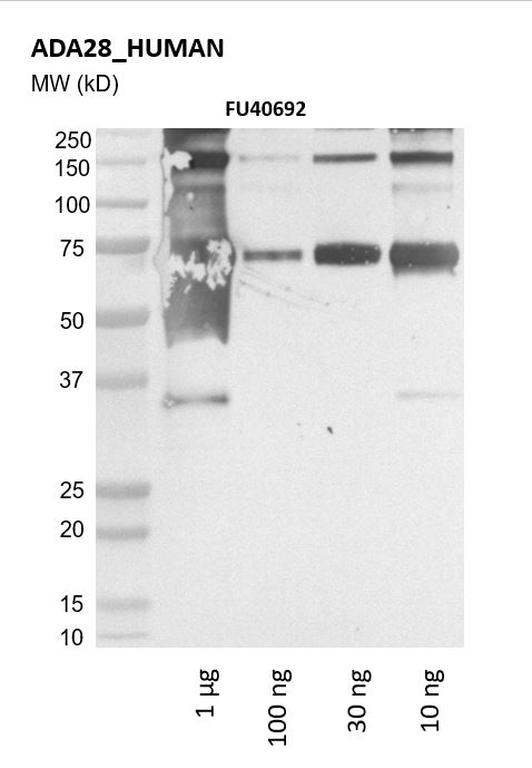 Ankyron ADA28_HUMAN Clone FU40692
