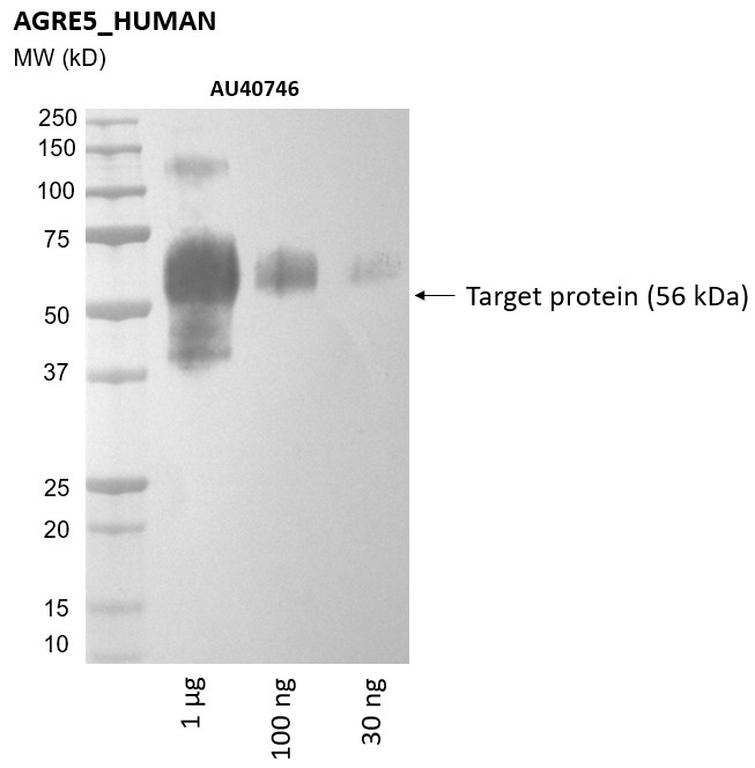Ankyron AGRE5_HUMAN Clone AU40746