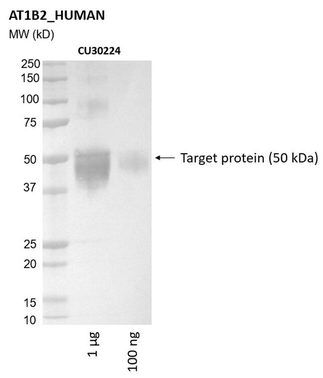 Ankyron AT1B2_HUMAN Clone CU30224