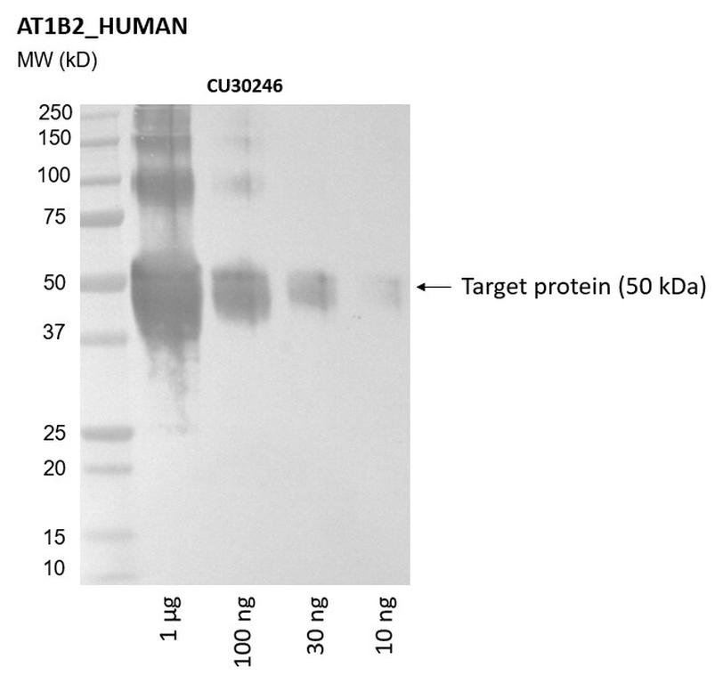 Ankyron AT1B2_HUMAN Clone CU30246