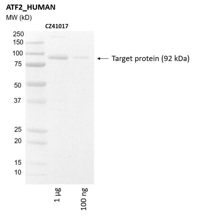 Ankyron ATF2_HUMAN Clone CZ41017