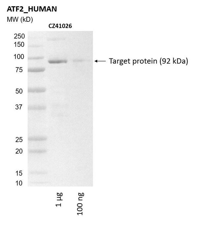 Ankyron ATF2_HUMAN Clone CZ41026