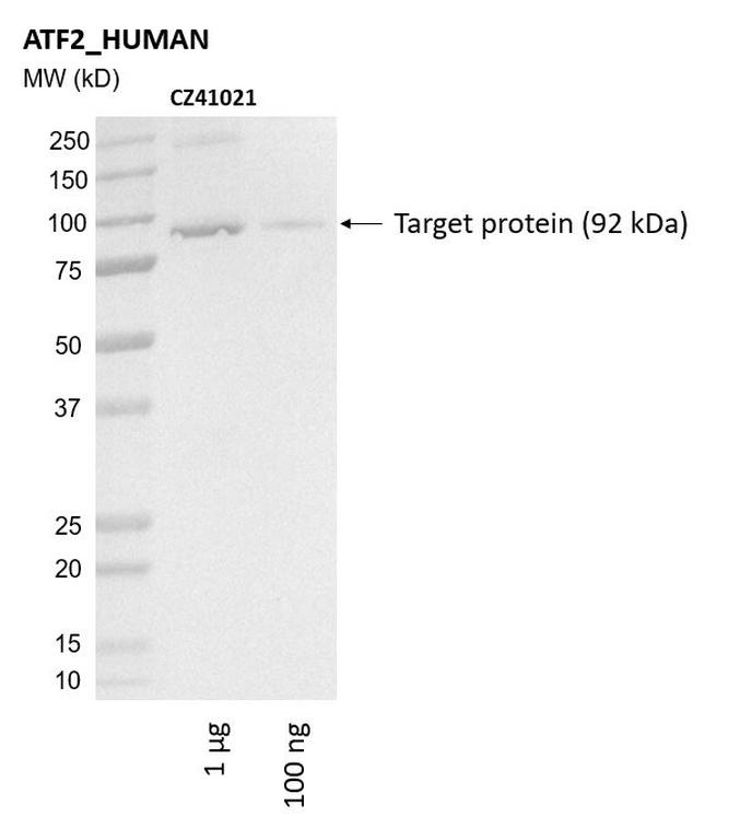 Ankyron ATF2_HUMAN Clone CZ41021