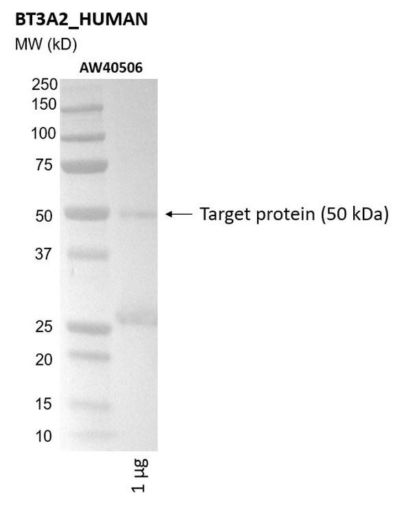 Ankyron BT3A2_HUMAN Clone AW40506