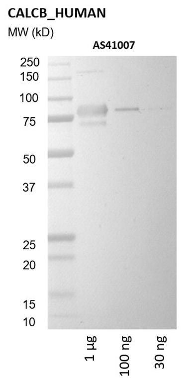 Ankyron CALCB_HUMAN Clone AS41007