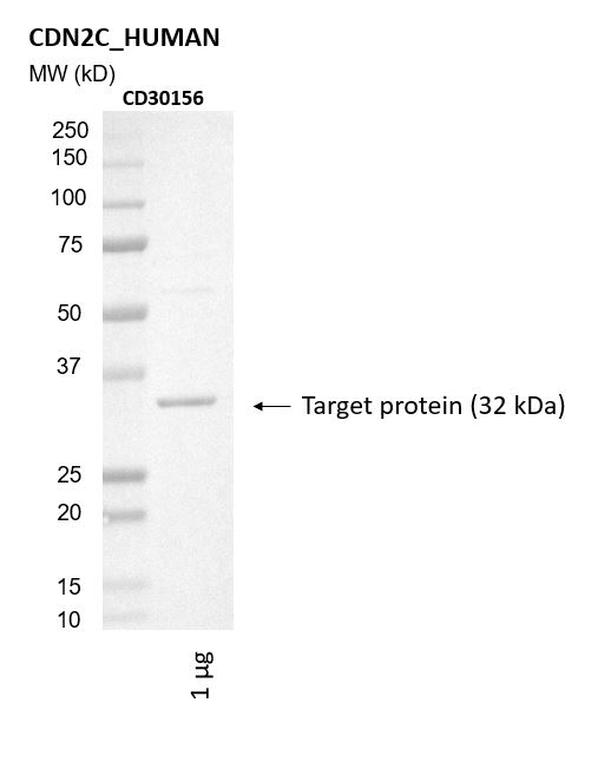 Ankyron CDN2C_HUMAN Clone CD30156