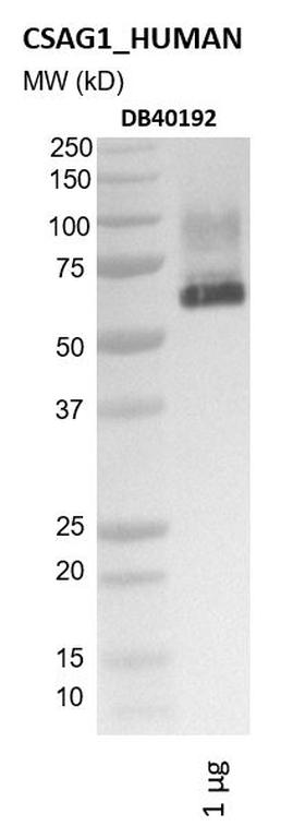 Ankyron CSAG1_HUMAN Clone DB40192