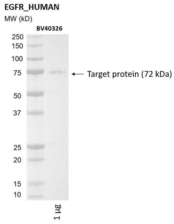 Ankyron EGFR_HUMAN Clone BV40326