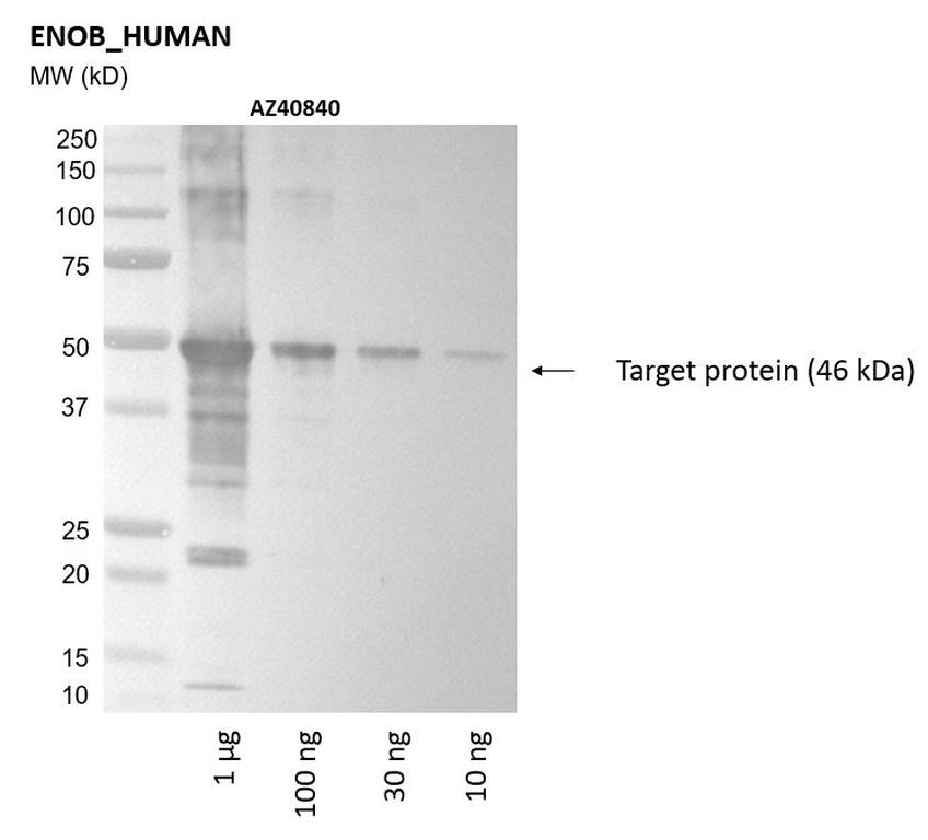 Ankyron ENOB_HUMAN Clone AZ40840