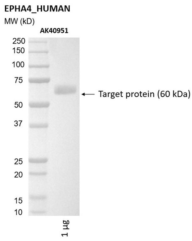 Ankyron EPHA4_HUMAN Clone AK40951