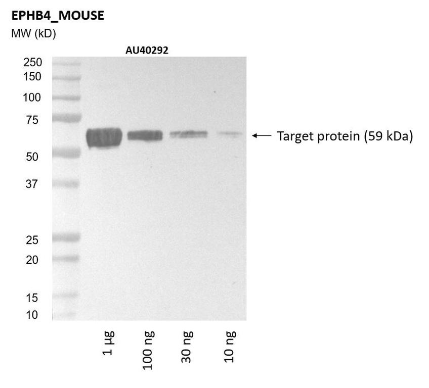 Ankyron EPHB4_MOUSE Clone AU40292
