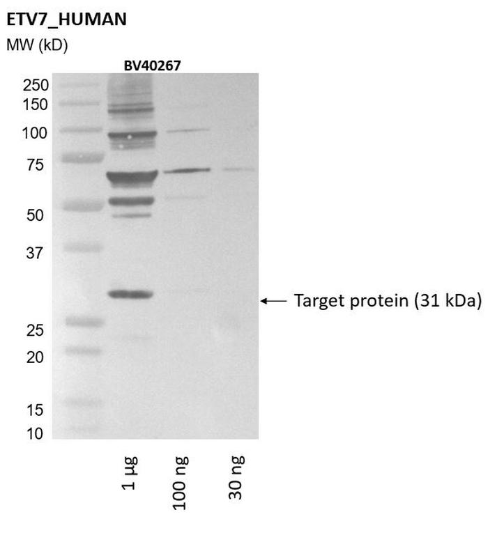 Ankyron ETV7_HUMAN Clone BV40267
