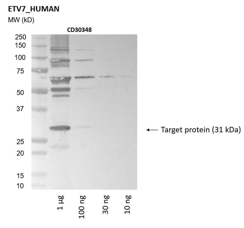 Ankyron ETV7_HUMAN Clone CD30348