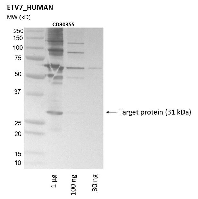 Ankyron ETV7_HUMAN Clone CD30355