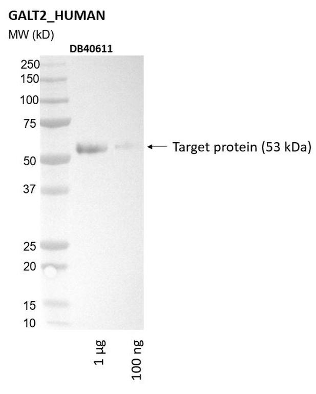 Ankyron GALT2_HUMAN Clone DB40611