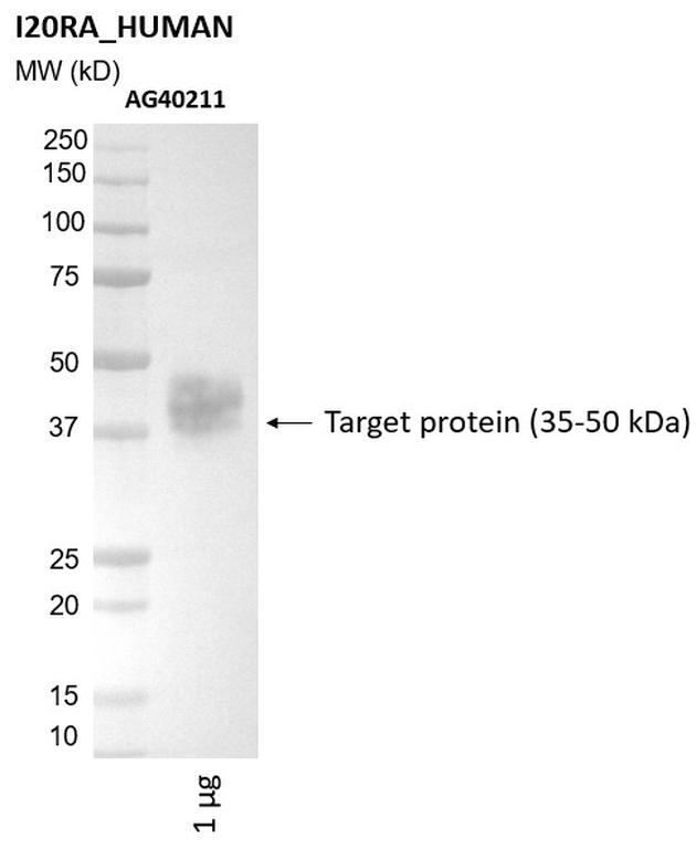 Ankyron I20RA_HUMAN Clone AG40211