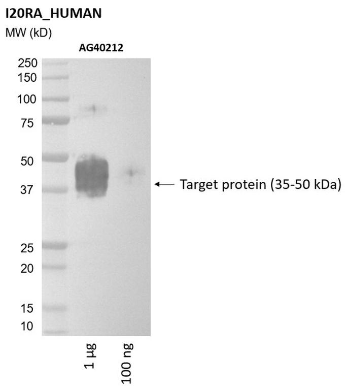 Ankyron I20RA_HUMAN Clone AG40212