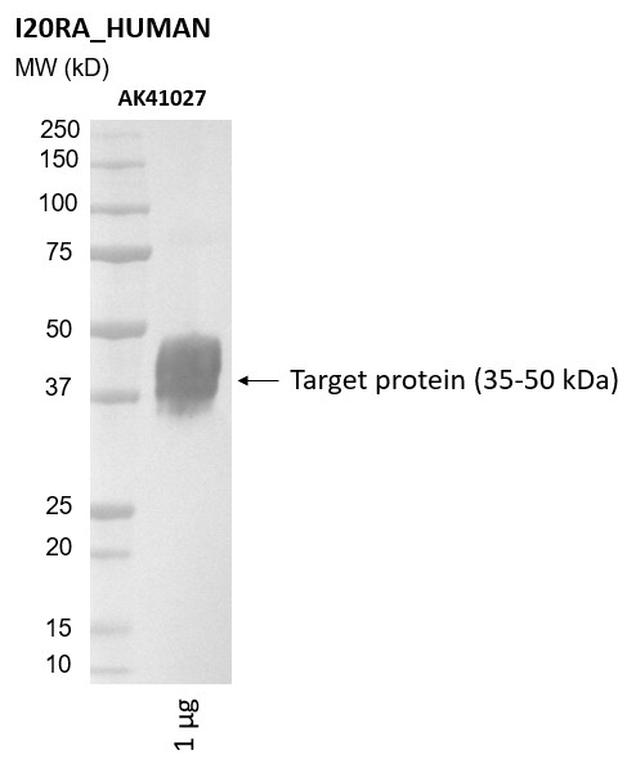 Ankyron I20RA_HUMAN Clone AK41027