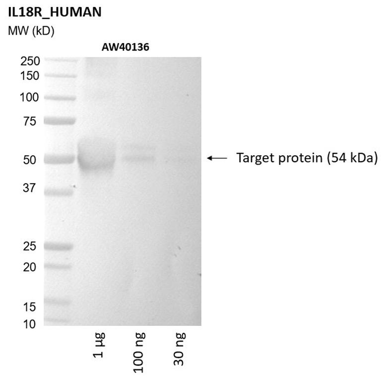 Ankyron IL18R_HUMAN Clone AW40136