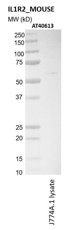 Ankyron IL1R2_MOUSE Clone AT40613