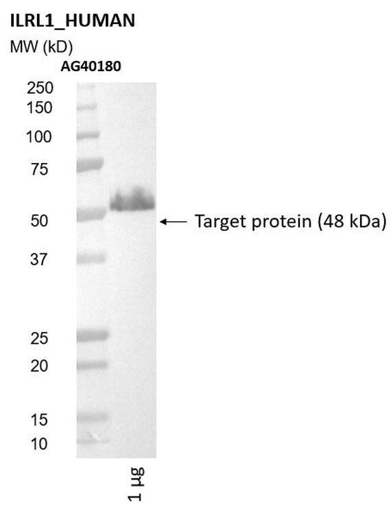 Ankyron ILRL1_HUMAN Clone AG40180