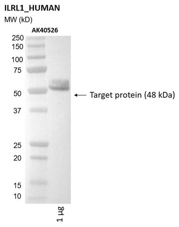 Ankyron ILRL1_HUMAN Clone AK40526
