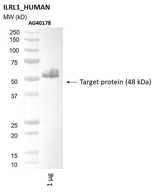 Ankyron ILRL1_HUMAN Clone AG40178