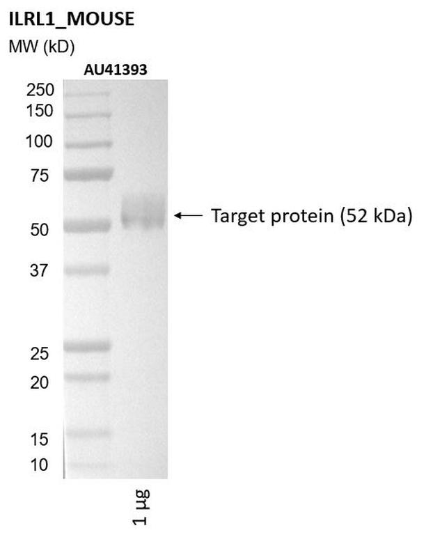 Ankyron ILRL1_MOUSE Clone AU41393