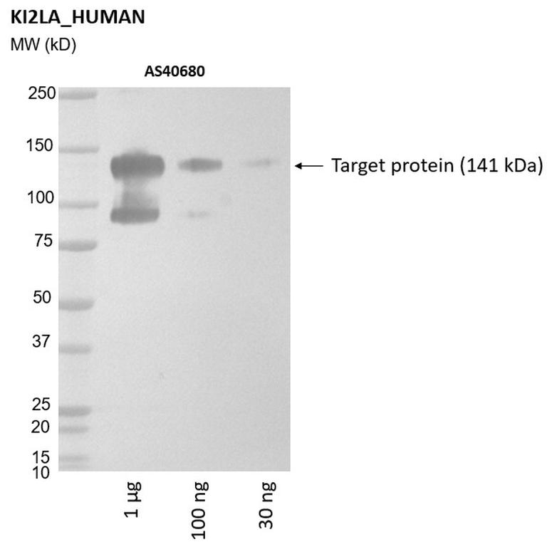 Ankyron KI2LA_HUMAN Clone AS40680