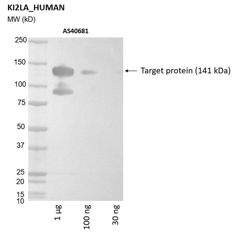 Ankyron KI2LA_HUMAN Clone AS40681