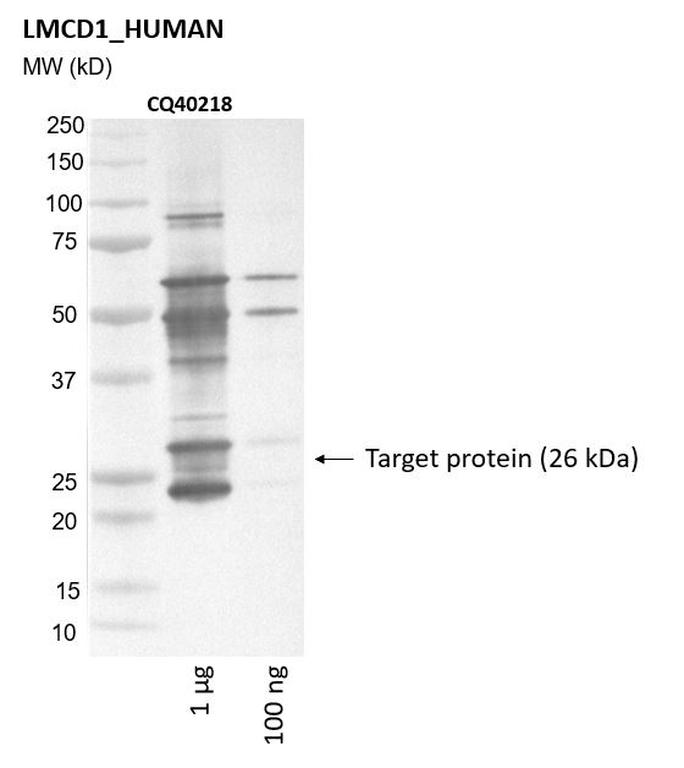 Ankyron LMCD1_HUMAN Clone CQ40218