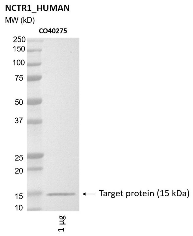 Ankyron NCTR1_HUMAN Clone CO40275