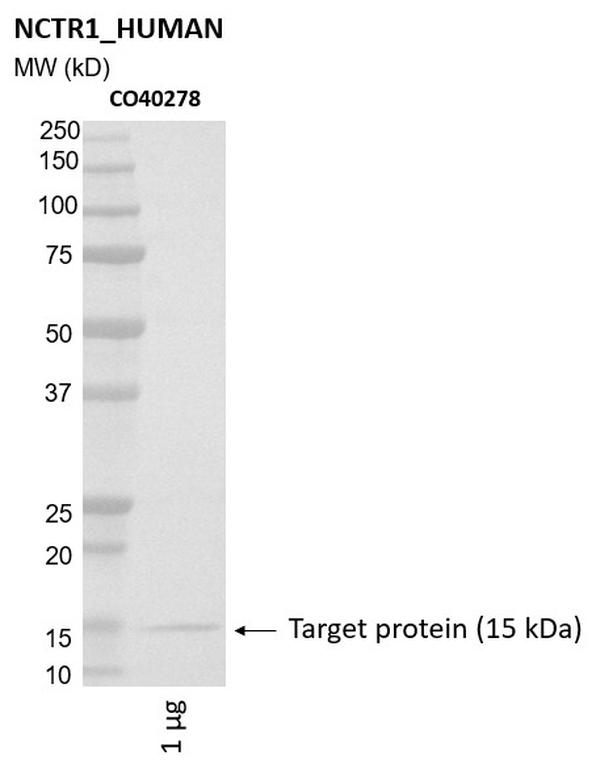 Ankyron NCTR1_HUMAN Clone CO40278