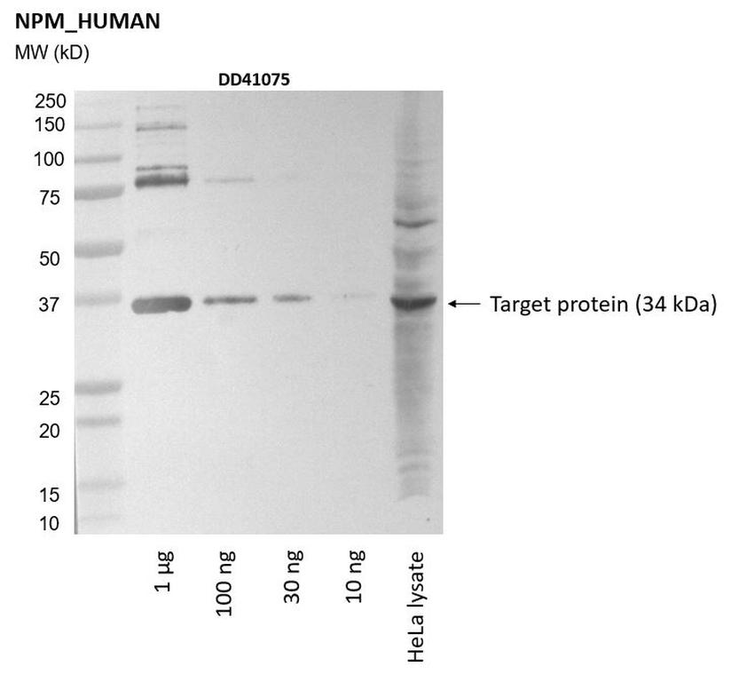 Ankyron NPM_HUMAN Clone DD41075