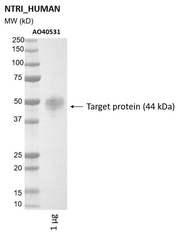 Ankyron NTRI_HUMAN Clone AO40531