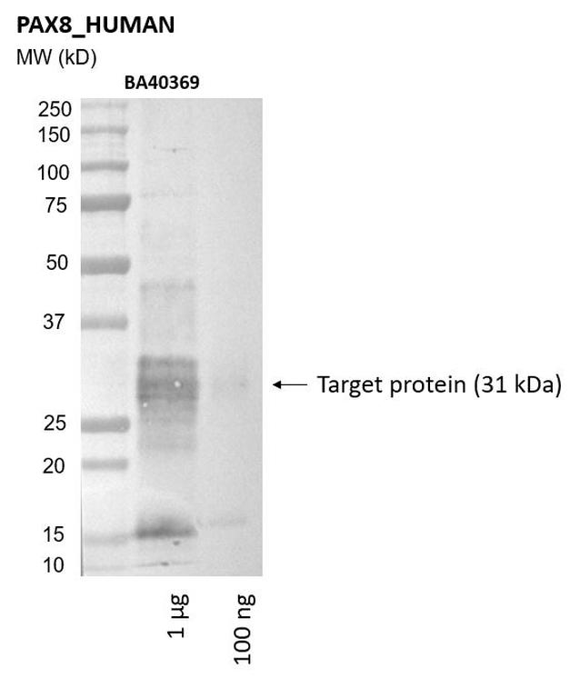 Ankyron PAX8_HUMAN Clone BA40369