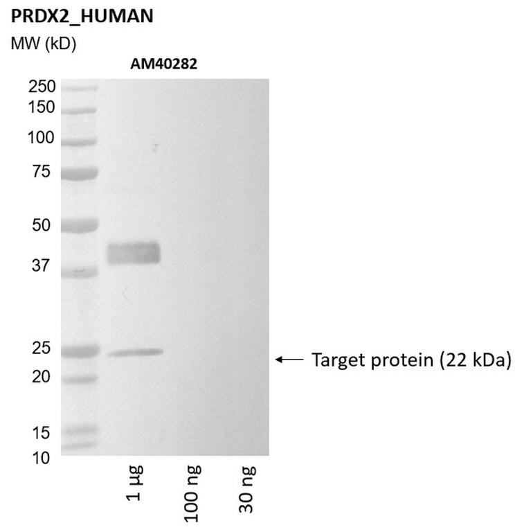 Ankyron PRDX2_HUMAN Clone AM40282