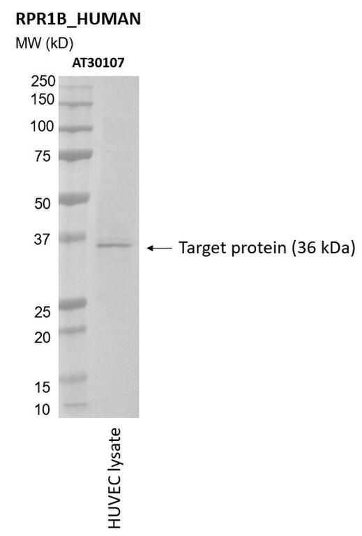 Ankyron RPR1B_HUMAN Clone AT30107