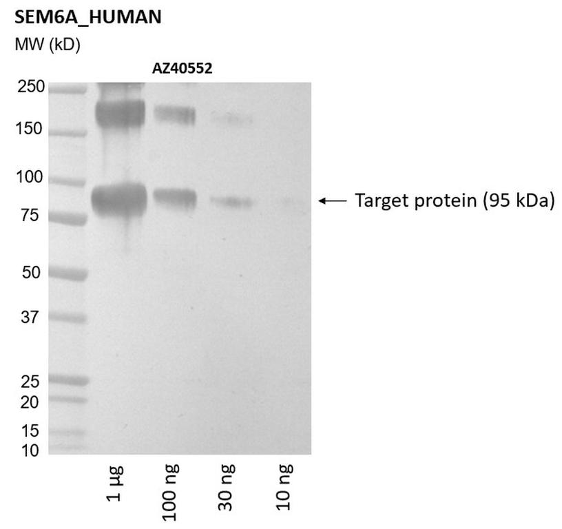 Ankyron SEM6A_HUMAN Clone AZ40552