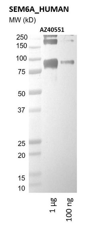 Ankyron SEM6A_HUMAN Clone AZ40551