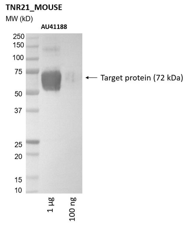 Ankyron TNR21_MOUSE Clone AU41188
